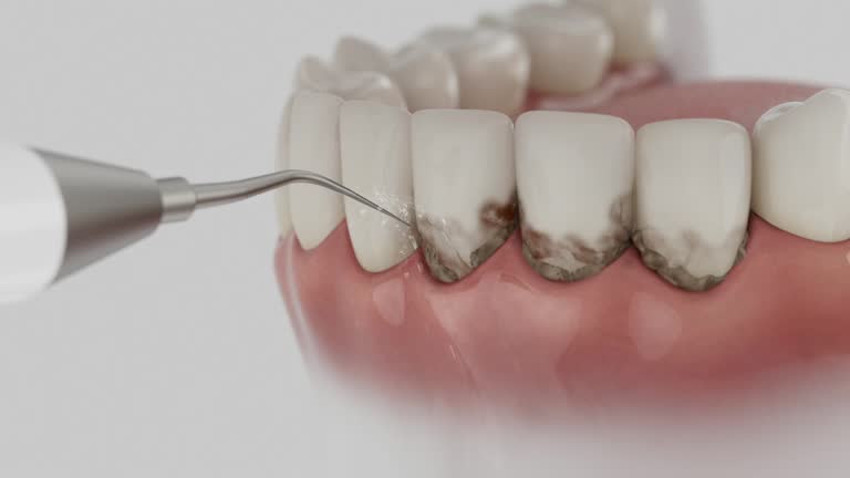 Reliable Tooth Extraction contractor in Buchanan County County, VA by Dentist Open Now